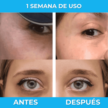 Removedor de Ojeras con Extractos Naturales